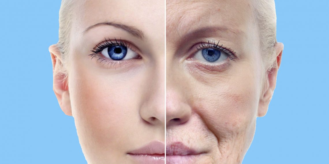 Why Wrinkles Happen And How To Get Rid Of Them The Cop Cart